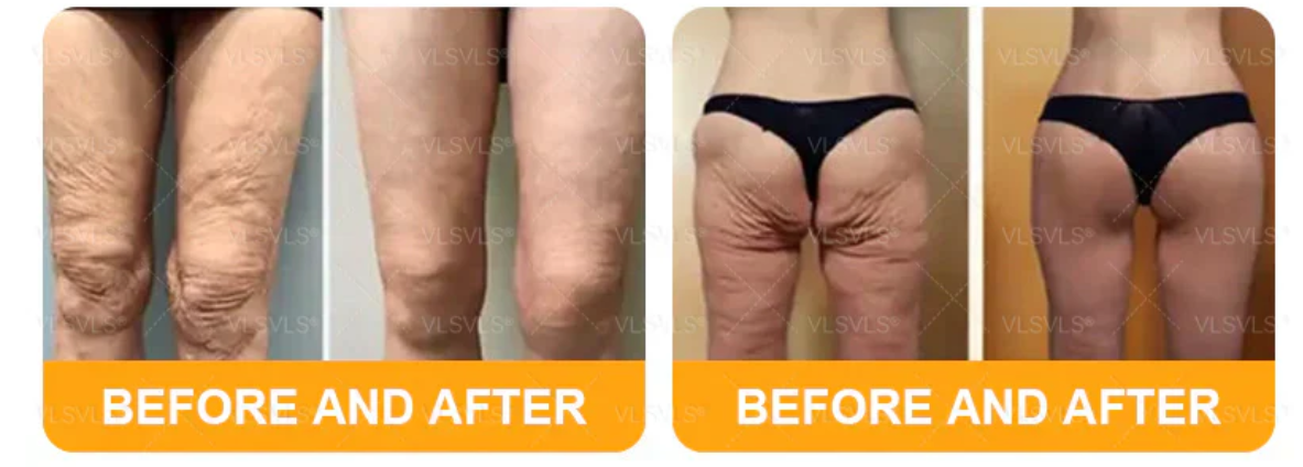 Senzio Balm Application Before & After Part 1